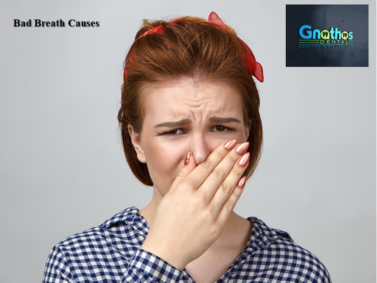 Bad Breath (Halitosis): Causes, Diagnosis and Treatment