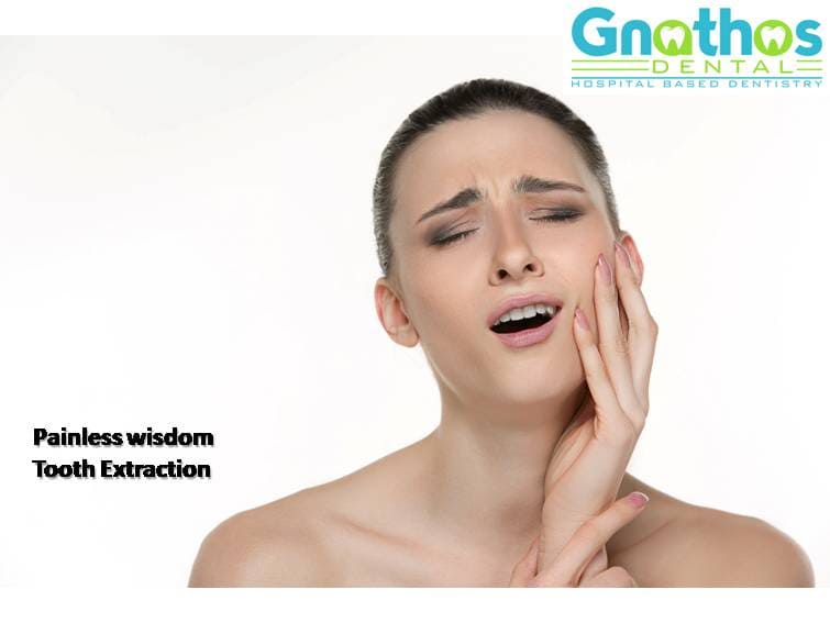 Tooth Removal (Extraction) in Hyderabad
