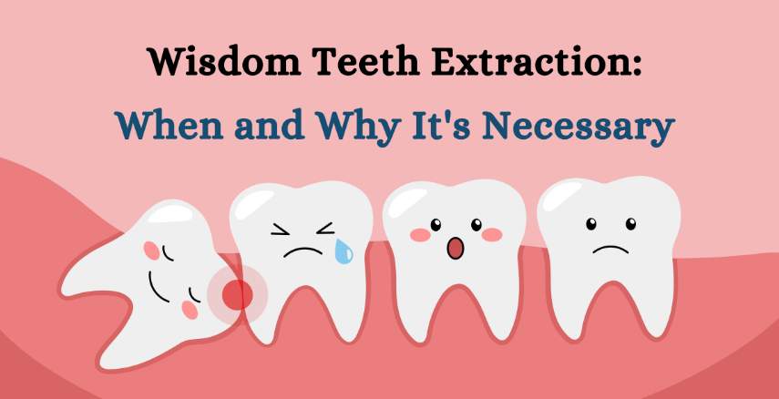 Wisdom Teeth Extraction: When and Why It’s Necessary