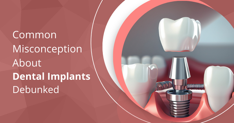 Common Misconceptions About Dental Implants Debunked