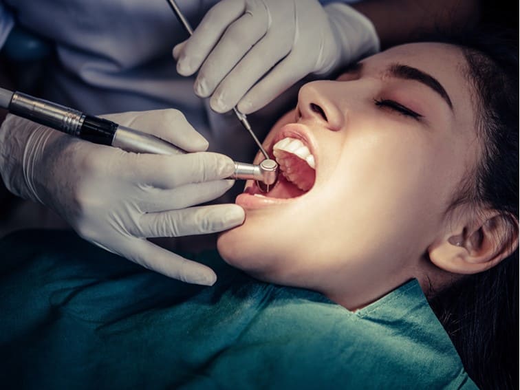 Dental Fillings – Types, Procedure and Cost