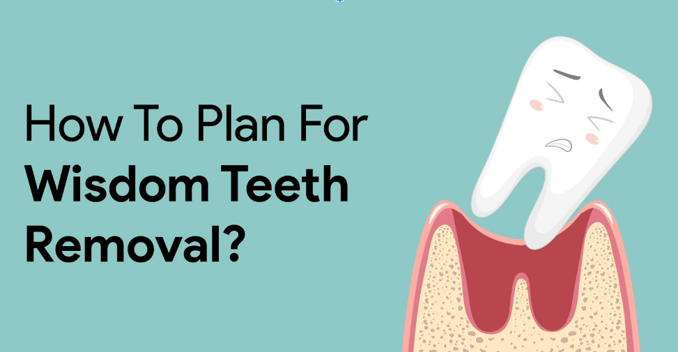 How To Plan For Wisdom Teeth Removal?