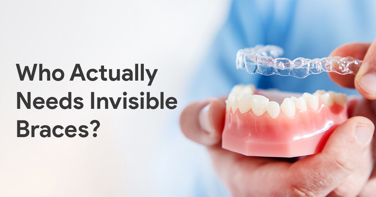 Who Actually Needs Invisible Braces?