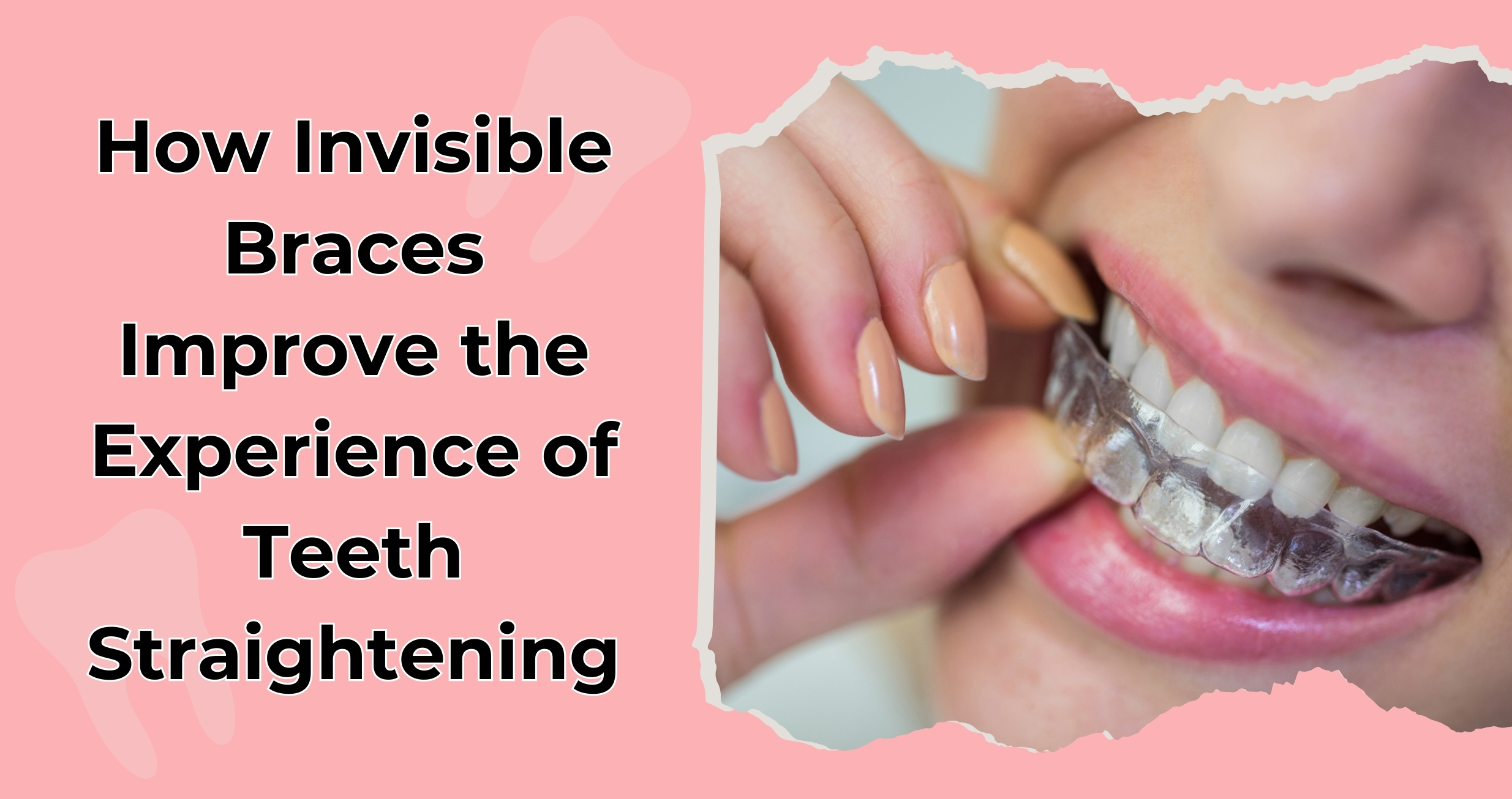 How Invisible Braces Improve the Experience of Teeth Straightening