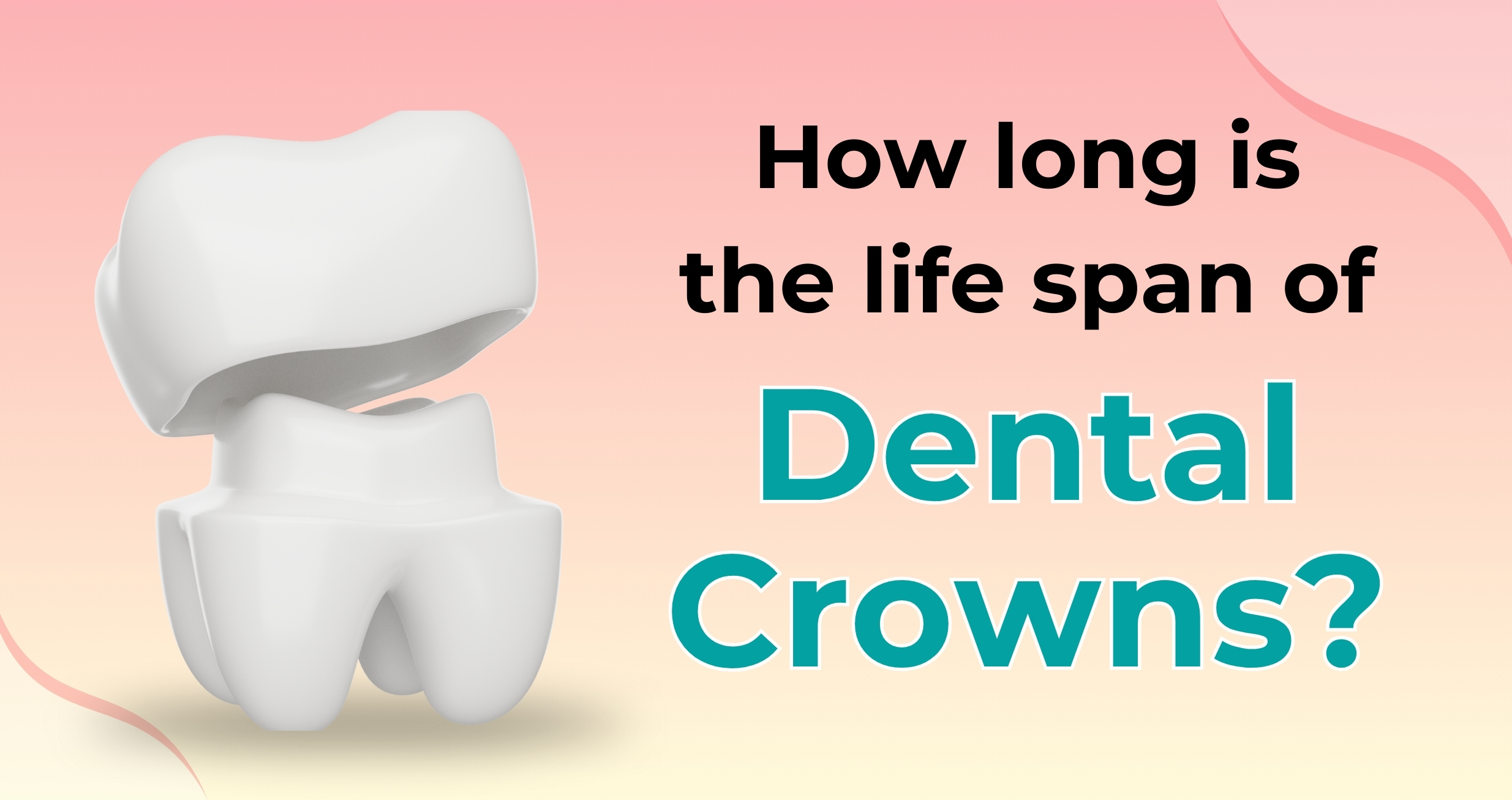 How Long Is The Life Span Of Dental Crowns?