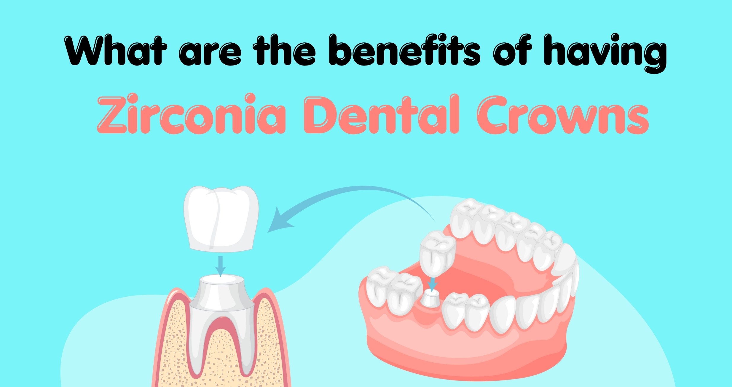 What Are The Benefits Of Having Zirconia Dental Crowns?