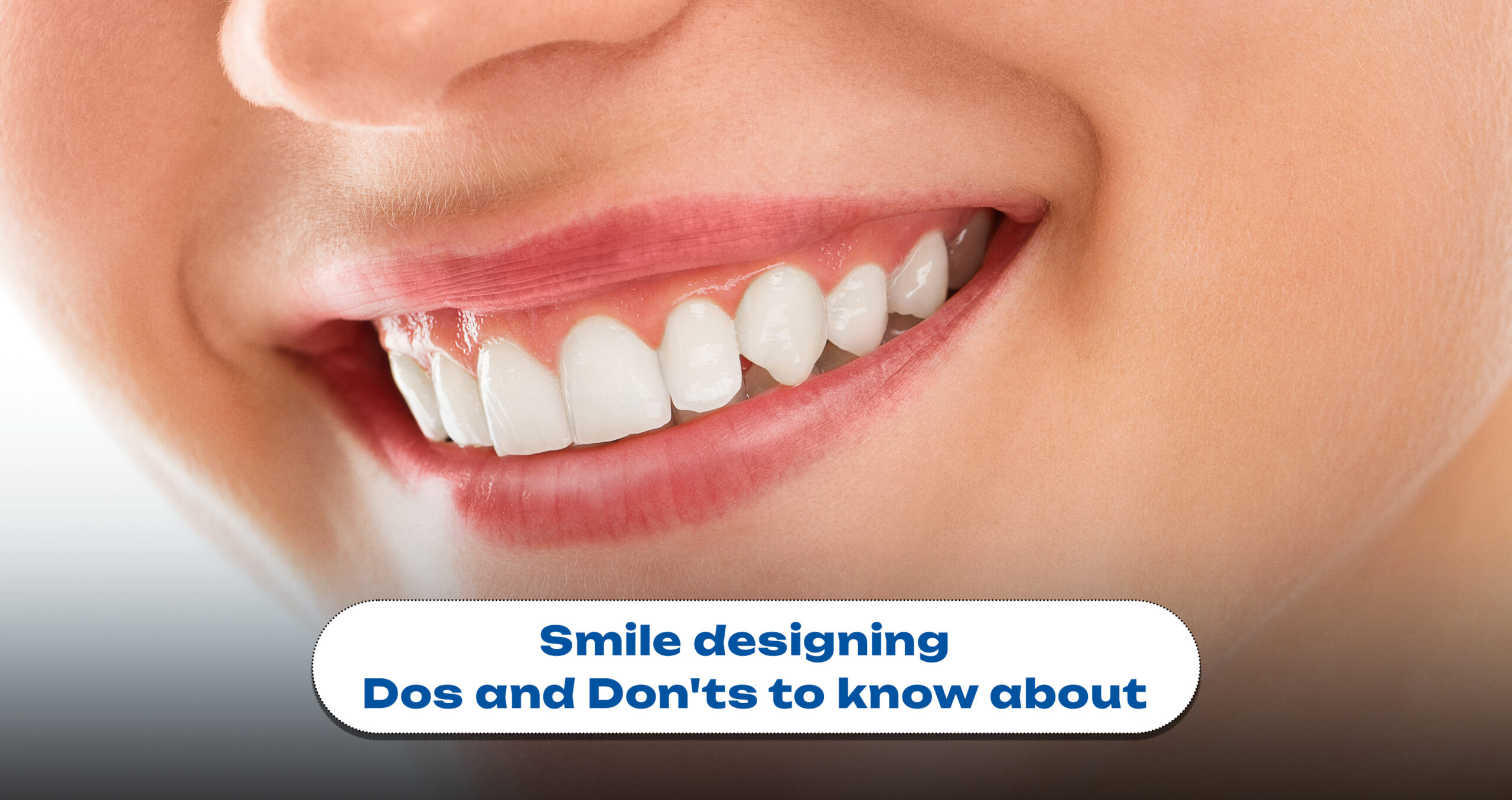 Smile Designing: Dos and Don’ts To Know About