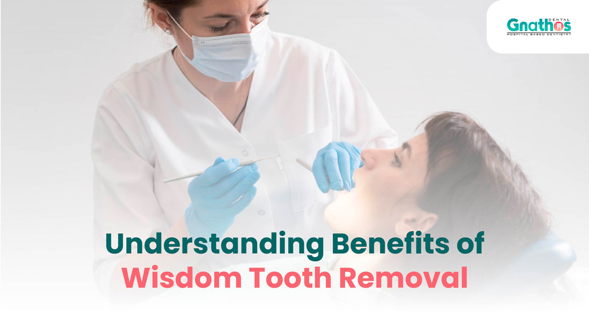 Why Dentists Frequently Recommend Wisdom Teeth Removal?