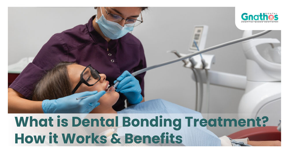 What is Dental Bonding Treatment? How it Works & Benefits