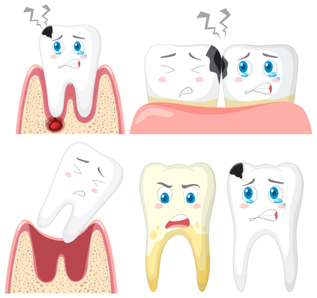 Myths & Facts of Wisdom tooth