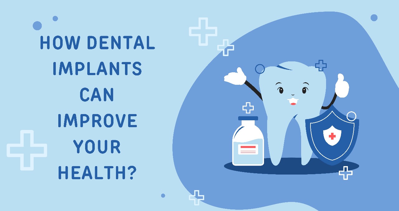 How Dental Implants can Improve your Health?