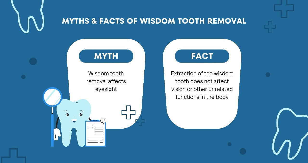 Myths & Facts of Wisdom Tooth Removal